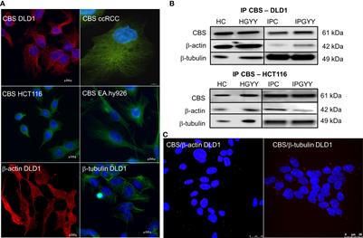 Cystathionine β-synthase affects organization of cytoskeleton and modulates carcinogenesis in colorectal carcinoma cells